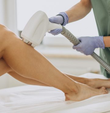 Laser epilation, hair removal therapy